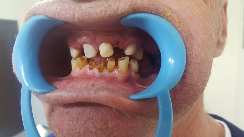Picture of a transformed smile