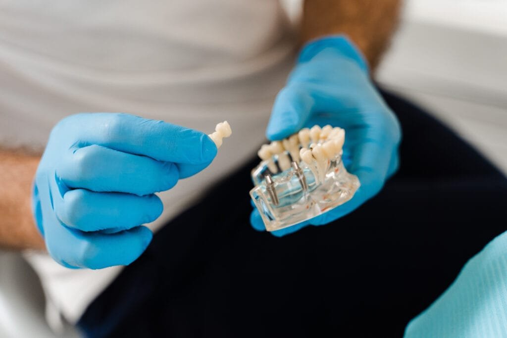 Close-up of a dental implant model showing how implants can be removed