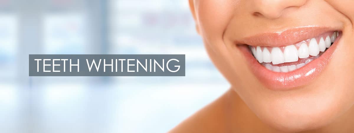 Teeth Whitening – The Dentist, Implants, Veneers, Emergency Center