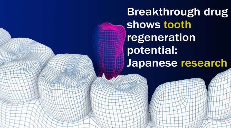 breakthrough-drug-shows-tooth-regeneration-potential-japanese-research-1689072888-2235