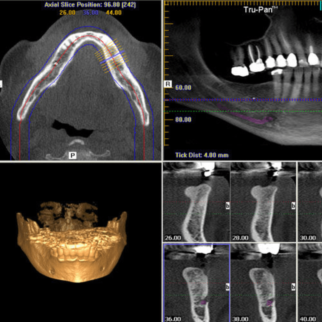 3D scans CBCT in Birmingham