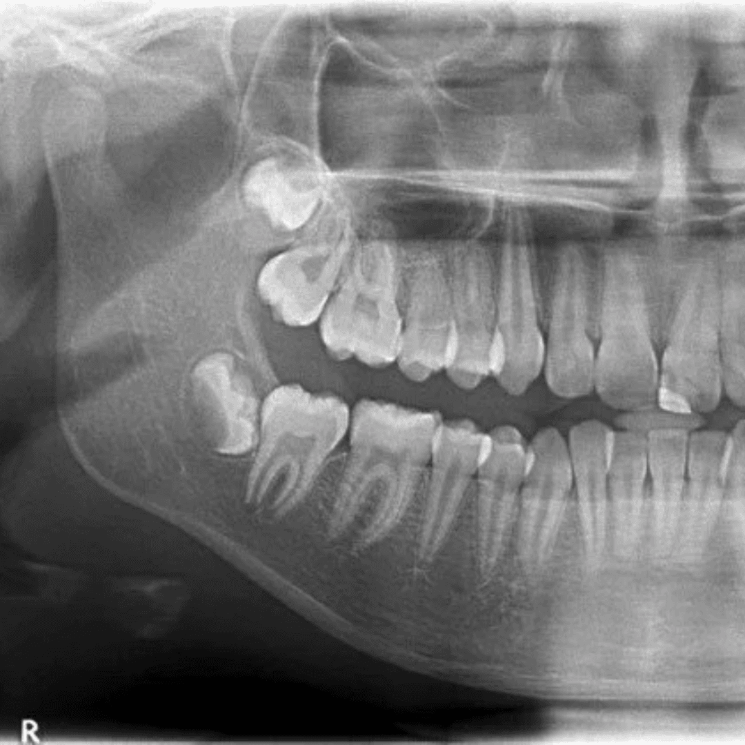 Book an OPG scan in Birmingham