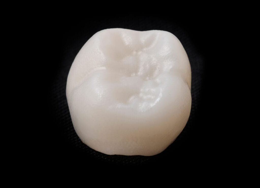 Close-up of a natural-looking ceramic dental crown