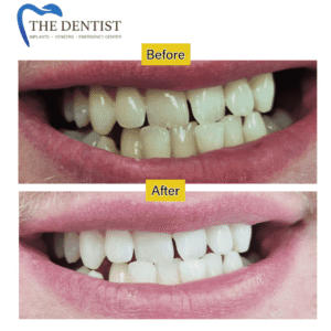 Complete smile enhancement – expert cosmetic dental care in Great Barr, West Midlands