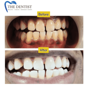 Complete smile enhancement – expert cosmetic dental care in Great Barr, West Midlands
